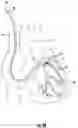 Fig. 06 - Method and apparatus for reliably placing and adjusting a left ventricular pacemaker lead
