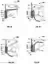 Fig. 10 - Fitted covering having diagonal elastic bands