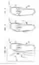 Fig. 09 - Shoe footbed system and method with interchangeable cartridges