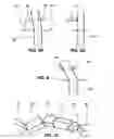 Fig. 04 - Method and device for shaping an orthodontic archwire