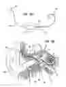 Fig. 04 - Optical waveguide vibration sensor for use in hearing aid