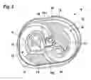 Fig. 07 - Two-stroke engine assembly