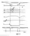 Fig. 04 - KICKBACK PREVENTING CIRCUIT FOR ENGINE