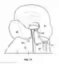 Fig. 09 - Jacket and method for surviving an avalanche