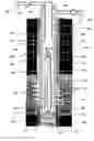 Fig. 01 - System and method for fracturing and gravel packing a wellbore