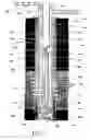 Fig. 02 - System and method for fracturing and gravel packing a wellbore