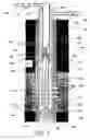Fig. 06 - System and method for fracturing and gravel packing a wellbore