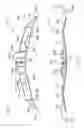 Fig. 02 - Control system for an aircraft