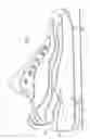 Fig. 02 - Heeling apparatus and method