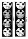 Fig. 07 - Reduction of blurring in view angle tilting MRI