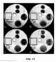 Fig. 08 - Reduction of blurring in view angle tilting MRI