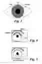 Fig. 02 - Pupilometer