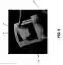 Fig. 07 - Case divider for organizing patient films