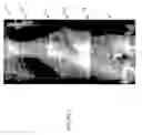 Fig. 02 - Enhanced image processing method for the presentation of digitally-combined medical images