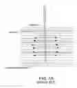 Fig. 02 - Electrosurgical working end for controlled energy delivery