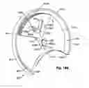Fig. 197 - Cycling suturing and knot-tying device