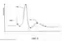 Fig. 04 - Cardiac tachyarrhythmia therapy selection based on patient response information