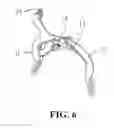 Fig. 06 - Bike brake clamp