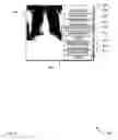 Fig. 06 - Systems, methods and apparatus for a reference display of a digital image detector