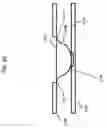 Fig. 20 - Microelectronic assemblies incorporating inductors