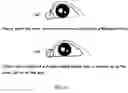 Fig. 11 - Method of beautification and facelifting using a stretch tape