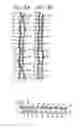 Fig. 07 - Industrial two-layer fabric