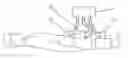 Fig. 01 - Driving device for external counterpulsation