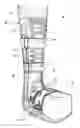 Fig. 01 - Suspension walker