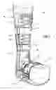 Fig. 02 - Suspension walker