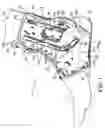 Fig. 02 - Ankle brace