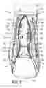 Fig. 03 - Ankle brace