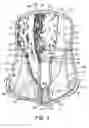 Fig. 04 - Ankle brace