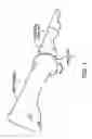 Fig. 02 - Method and apparatus for manipulating a toe joint