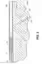 Fig. 04 - TMR shunt