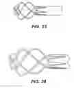 Fig. 43 - TMR shunt