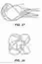 Fig. 44 - TMR shunt