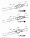 Fig. 46 - TMR shunt