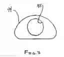 Fig. 04 - Catheter insertion apparatus