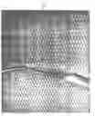 Fig. 09 - Catheter insertion apparatus