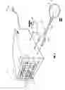 Fig. 02 - Method & apparatus for pressurizing a body cavity for diagnostic and rehabilitative purposes