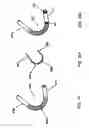Fig. 23 - System and method for a magnetic catheter tip