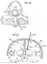 Fig. 09 - Self-sealing catheter for deformable tissue