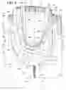 Fig. 04 - Absorbent garment having a garment shell