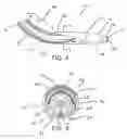 Fig. 07 - Ablation instrument and method