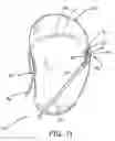Fig. 09 - Ablation instrument and method