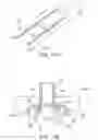 Fig. 16 - Adhesive-based anastomosis method and system