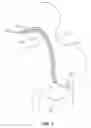 Fig. 02 - Gastric device and endoscopic delivery system