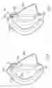 Fig. 04 - Diving mask and method for the manufacture thereof