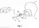 Fig. 02 - Portable pressure transducer, pneumotach for use therewith, and associated methods