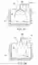 Fig. 10 - Apparatus for separating matter from an exposed surface